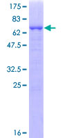 12.5% SDS-PAGE Stained with Coomassie Blue.